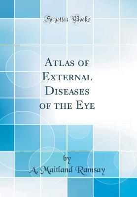 Read online Atlas of External Diseases of the Eye (Classic Reprint) - A Maitland Ramsay | ePub