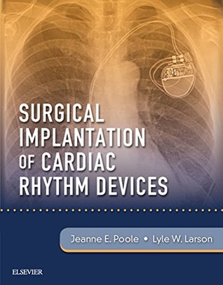 Read online Surgical Implantation of Cardiac Rhythm Devices E-Book - Jeanne Poole | PDF