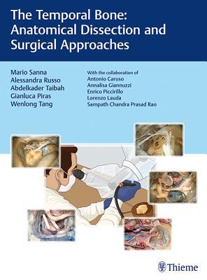 Read The Temporal Bone: Anatomical Dissection and Surgical Approaches - Mario Sanna file in PDF